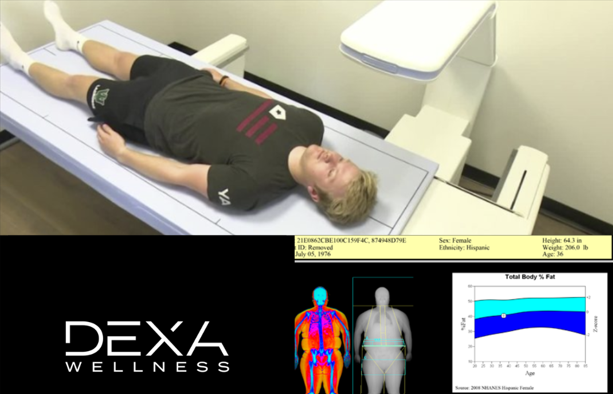 DEXA scan in progress with body composition results and DEXA Wellness logo