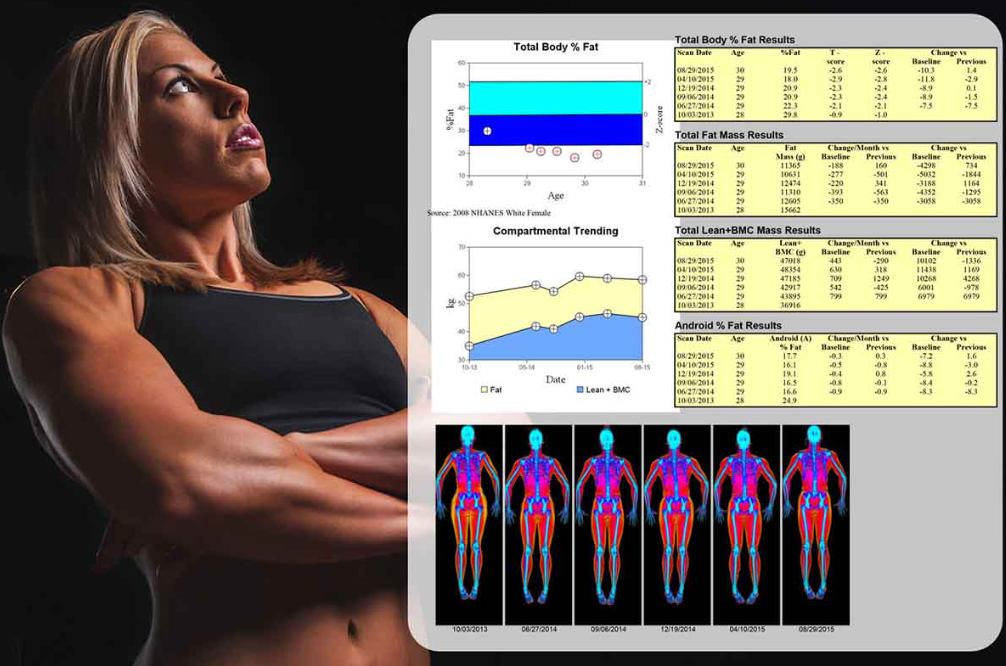 DEXA scan results